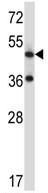 Anti-Neurokinin 3 Receptor NK3 antibody (ab123303) at 1/100 dilution + K562 cell line lysates at 35 µg