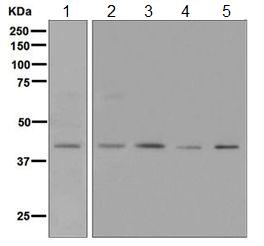 All lanes : Anti-Neurokinin A Receptor antibody [EPR6838(B)] (ab124998) at 1/1000 dilutionLane 1 : Caco-2 cell lysateLane 2 : Human heart lysateLane 3 : HT29 cell lysateLane 4 : K562 cell lysateLane 5 : HeLa cell lysateLysates/proteins at 10 µg per lane.SecondaryGoat anti-Rabbit HRP at 1/2000 dilution
