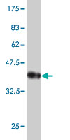 Western blot against tagged recombinant protein immunogen using ab56882 Neuroligin 1 antibody at 1ug/ml.