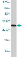 Western blot against tagged recombinant protein immunogen using ab57375 Neuroligin 3 antibody at 1ug/ml.