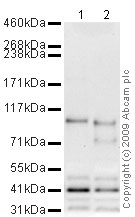 All lanes : Anti-Neuropilin 1 antibody (ab60606) at 1 µg/mlLane 1 : Skeletal Muscle (Mouse) Tissue Lysate (ab29711)Lane 2 : Skeletal Muscle (Rat) Tissue Lysate - normal tissue (ab29376)Lysates/proteins at 10 µg per lane.SecondaryGoat polyclonal to Rabbit IgG - H&L - Pre-Adsorbed (HRP) at 1/3000 dilutionPerformed under reducing conditions.