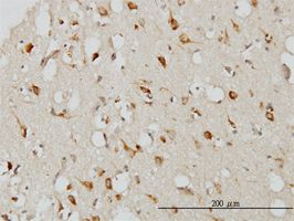 Neuroserpin antibody (ab55587) used in immunohistochemistry at 3ug/ml on formalin fixed and paraffin embedded human cerebral cortex.