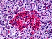 ab117592, at 5 µg/ml, staining Neurotensin Receptor 1 in Formalin-fixed, Paraffin-embedded Human Pancreas tissue by Immunohistochemistry.