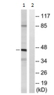 All lanes : Anti-Neurotensin Receptor 1 antibody (ab117592) at 1/500 dilutionLane 1 : MCF7 cell extractLane 2 : MCF7 cell extract with immunizing peptide