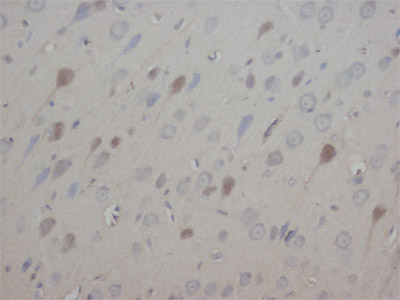 ab65804 at 0.5µg/ml staining Neurotrophin 3 in rat brain tissue sections.
