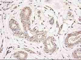 ab124410 at 1/50 dilution staining Neurotrophin 3 in Paraffin-embedded Human breast tissue by Immunohistochemistry.