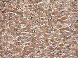 ab124410 at 1/50 dilution staining Neurotrophin 3 in Paraffin-embedded Human liver tissue by Immunohistochemistry.