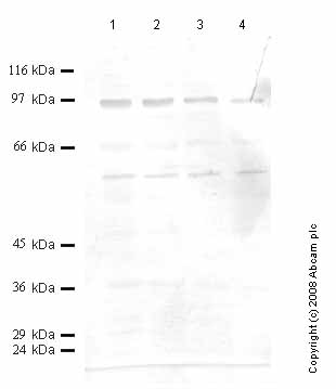 All lanes : Anti-Neurotrypsin antibody (ab59452) at 1/1000 dilutionLane 1 : Tissue lysate prepared from mouse epididymis at 30 µlLane 2 : Tissue lysate prepared from mouse epididymis at 20 µlLane 3 : Tissue lysate prepared from mouse epididymis at 15 µlLane 4 : Tissue lysate prepared from mouse epididymis at 10 µl