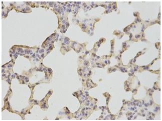 Immunohistochemical analysis of paraffin-embedded Mouse liver cancer tissue labeling Neutrophil Bactericidal Protein BP30 with ab196732 at 1/200 dilution.