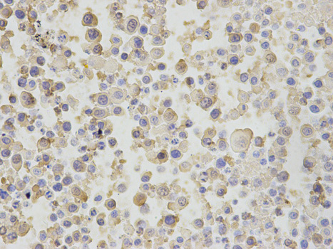 Immunohistochemistry (Formalin/PFA-fixed paraffin-embedded sections) analysis of mouse cancer tissue labelling Neutrophil Bactericidal Protein BP30 with ab187519 at 1/200. Magnification: 400x.