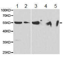 All lanes : Anti-Neutrophil Bactericidal Protein BP30 antibody (ab187519) at 1/500 dilutionLane 1 : Jurkat cell extractsLane 2 : HepG2 cell extractsLane 3 : SK-Hep1 cell extractsLane 4 : Mouse liver cell extractsLane 5 : Mouse thymus cell extracts