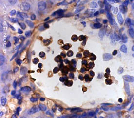 ab21595 at 1/20 dilution staining rat liver tissue sections by Immunohistochemistry (Formalin/PFA-fixed paraffin-embedded sections). The rat was challenged with LPS at 100ug/Kg i.p. The tissue sections were formaldehyde fixed and incubated with the antibody for 2 hours. A biotinylated goat anti-rabbit IgG antibody was used as the secondary antibody.See Abreview