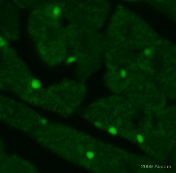 ab16502 stining the nuclei of the cardiac cells in rat tissue. The tissues were fixed (animals perfused fixed) with 4% PFA and later postfixed overnight in the same fixative. They were cryoprotected in 30% sucrose and cut using a cryostat.See Abreview