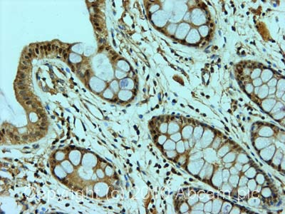 IHC image of ab2478 staining in human normal colon formalin fixed paraffin embedded tissue section, performed on a Leica BondTM system using the standard protocol F. The section was pre-treated using heat mediated antigen retrieval with sodium citrate buffer (pH6, epitope retrieval solution 1) for 20 mins. The section was then incubated with ab2478, 5µg/ml, for 15 mins at room temperature and detected using an HRP conjugated compact polymer system. DAB was used as the chromogen. The section was then counterstained with haematoxylin and mounted with DPX.For other IHC staining systems (automated and non-automated) customers should optimize variable parameters such as antigen retrieval conditions, primary antibody concentration and antibody incubation times.