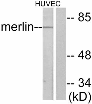 All lanes : Anti-NF2 / Merlin antibody (ab47502) at 1/500 dilutionLane 1 : Extracts from HuvEc cells treated with IFN alpha (1000U/ml, 18 hours)Lane 2 : Extracts from HuvEc cells treated with IFN alpha (1000U/ml, 18 hours) and peptideLysates/proteins at 30 µg per lane.