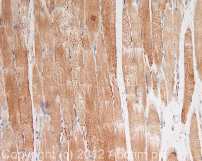 IHC image of NF2/Merlin staining in human skeletal muscle formalin fixed paraffin embedded tissue section, performed on a Leica BondTM system using the standard protocol F. The section was pre-treated using heat mediated antigen retrieval with sodium citrate buffer (pH6, epitope retrieval solution 1) for 20 mins. The section was then incubated with ab88957, 10µg/ml, for 15 mins at room temperature and detected using an HRP conjugated compact polymer system. DAB was used as the chromogen. The section was then counterstained with haematoxylin and mounted with DPX. For other IHC staining systems (automated and non-automated) customers should optimize variable parameters such as antigen retrieval conditions, primary antibody concentration and antibody incubation times.