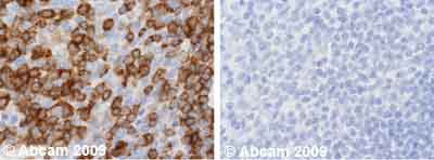 Ab2796 staining Human normal tonsil tissue. Staining is localised to cytoplasm and nucleus.Left panel: with primary antibody at 1 ug/ml. Right panel: isotype control.Sections were stained using an automated system DAKO Autostainer Plus , at room temperature. Sections were rehydrated and antigen retrieved with the Dako 3-in-1 AR buffer EDTA pH 9.0 in a DAKO PT Link. Slides were peroxidase blocked in 3% H2O2 in methanol for 10 minutes. They were then blocked with Dako Protein block for 10 minutes (containing casein 0.25% in PBS), then incubated with primary antibody for 20 minutes, and detected with Dako Envision Flex amplification kit for 30 minutes. Colorimetric detection was completed with diaminobenzidine for 5 minutes. Slides were counterstained with Haematoxylin and coverslipped under DePeX. Please note that for manual staining we recommend to optimize the primary antibody concentration and incubation time (overnight incubation), and amplification may be required.