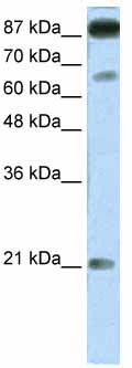 Anti-NFATC4 antibody (ab66781) at 1.25 µg/ml + Transfected 293T cell lysate at 10 µgSecondaryHRP conjugated anti-Rabbit IgG at 1/50000 dilution