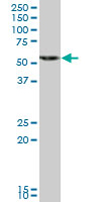 Anti-HMGCS1 antibody (ab67242) at 1/500 dilution + human liver tissue lysate at 25 µg/mlSecondaryGoat Anti-Mouse IgG (H&L)-HRP Conjugate at 1/2500 dilution