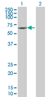 All lanes : Anti-HMGCS1 antibody (ab67242) at 1/500 dilutionLane 1 : HMGCS1 transfected 293T cell lysateLane 2 : Non transfected 293T cell lysateLysates/proteins at 25 µg/ml per lane.SecondaryGoat Anti-Mouse IgG (H&L)-HRP Conjugate at 1/2500 dilution