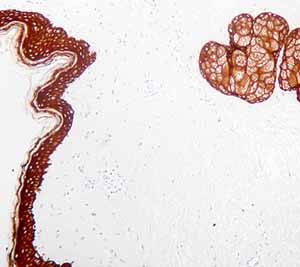 ab776 staining human skin tissue sections by IHC-P.