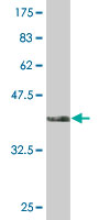 Anti-HNF1 beta antibody (ab76914) at 5 µg/ml + immunogen at 0.2 µgSecondaryGoat Anti-Mouse IgG (H&L)-HRP Conjugate at 1/5000 dilution
