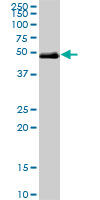 Anti-HNF1 beta antibody (ab76914) at 5 µg/ml + human lung cancer tissue lysate at 25 µgSecondaryGoat Anti-Mouse IgG (H&L)-HRP Conjugate at 1/2500 dilution