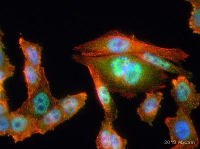 ab31645 staining hnRNP A2B1 in CHO cell line by ICC/IF (Immunocytochemistry/immunofluorescence). Cells were fixed with paraformaldehyde, permeabilized with 0.1% Triton X-100 and blocked with 1% BSA for 1 hour at 21°C. Samples were incubated with primary antibody (1/200 in PBS + 1% BSA) for 1 hour 30 minutes at 21°C. An Alexa Fluor®488-conjugated Goat anti-rabbit IgG polyclonal (1/1000) was used as the secondary antibody. Green - hnRNP, Red -alpha tubulin, Blue - nuclei.See Abreview