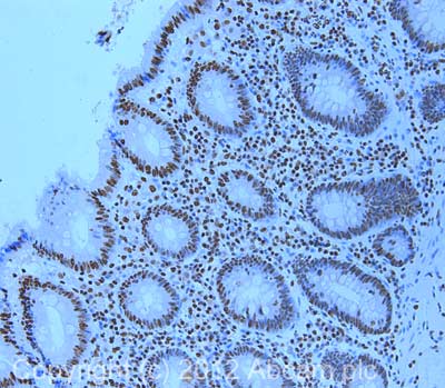 IHC image of ab31645 staining in human colon formalin fixed paraffin embedded tissue section, performed on a Leica BondTM system using the standard protocol F. The section was pre-treated using heat mediated antigen retrieval with sodium citrate buffer (pH6, epitope retrieval solution 1) for 20 mins. The section was then incubated with ab31645, 1µg/ml, for 15 mins at room temperature and detected using an HRP conjugated compact polymer system. DAB was used as the chromogen. The section was then counterstained with haematoxylin and mounted with DPX. For other IHC staining systems (automated and non-automated) customers should optimize variable parameters such as antigen retrieval conditions, primary antibody concentration and antibody incubation times.