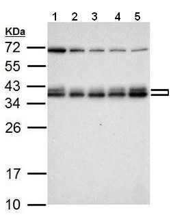 All lanes : Anti-hnRNP A2B1 antibody (ab183654) at 1/10000 dilutionLane 1 : 293T whole cell lysateLane 2 : A431 whole cell lysateLane 3 : HeLa whole cell lysateLane 4 : HepG2 whole cell lysateLane 5 : A375 whole cell lysateLysates/proteins at 30 µg per lane.