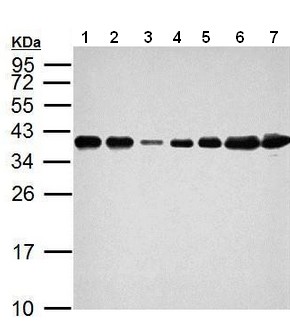 All lanes : Anti-hnRNP A2B1 antibody (ab183654) at 1/10000 dilutionLane 1 : Neuro2A whole cell lysateLane 2 : GL261 whole cell lysateLane 3 : C8D30 whole cell lysateLane 4 : NIH-3T3 whole cell lysateLane 5 : BCL-1 whole cell lysateLane 6 : Raw264.7 cell lysateLane 7 : C2C12 whole cell lysateLysates/proteins at 30 µg per lane.