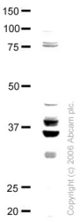 Anti-hnRNP A2B1 antibody (ab24409) at 1 µg/ml + HeLa (Human epithelial carcinoma cell line) Whole Cell Lysate at 20 µgSecondary Goat polyclonal to Rabbit IgG (Alexa Fluor® 680) at 1/10000 dilution Performed under reducing conditions.