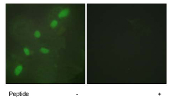 Immunofluorescence analysis of HeLa cells, using ab64800 at a 1:500 dilution.Left image untreated.Right image treated with peptide.