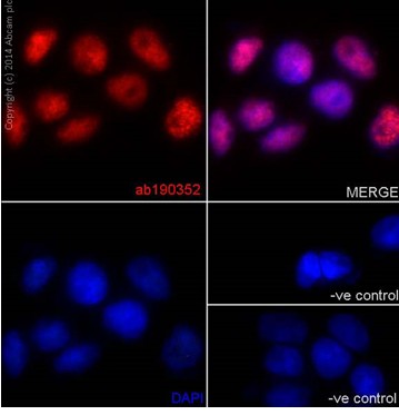 Immunofluorescent analysis of 4% paraformaldehyde fixed A431 cells labeling hnRNP G with ab190352 at a 1/100 dilution followed by Goat anti rabbit IgG (Alexa Fluor®555) at a 1/200 dilution (Red). Negative controls and DAPI staining also shown.
