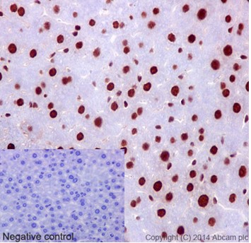 Immunohistochemical analysis of paraffin-embedded mouse liver tissue labeling hnRNP G with ab190352 at 1/250 dilution. Counter stain Hematoxylin. Negative control also shown lower left.