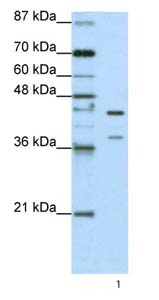 Anti-hnRNP K antibody (ab66894) at 1.25 µg/ml + HepG2 cell lysate at 10 µgSecondaryHRP conjugated anti-Rabbit IgG at 1/50000 dilution