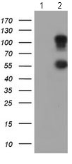 All lanes : Anti-HGFA Inhibitor 1 antibody [4E1] (ab128492) at 1/2000 dilutionLane 1 : HEK293T cell lysate transfected with pCMV6-ENTRY control cDNALane 2 : HEK293T cell lysate transfected with pCMV6-ENTRY HGFA Inhibitor 1 cDNALysates/proteins at 5 µg per lane.