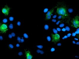 ab128492, at a dilution of 1/100, staining HGFA Inhibitor 1 in COS7 cells transiently transfected by pCMV6-ENTRY HGFA Inhibitor 1 by Immunofluorescence.