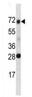 Anti-HGFA Inhibitor 1 antibody (ab124086) at 1/100 dilution + Human placenta tissue lysates at 35 µg
