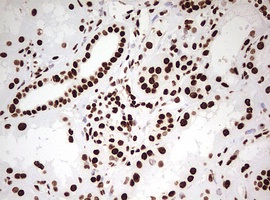Immunohistochemical analysis of paraffin embedded Human kidney tissue labeling HNRNPM with ab180530 at 1/150.