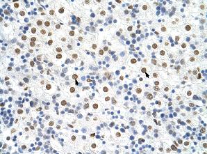 Tissue: Paraffin embedded human liver Cells with positive label: Hepatocytes (indicated with arrows)  Antibody concentration: 4µg/ml Magnification: 400XTissue: Paraffin embedded human liver Cells with positive label: Hepatocytes (indicated with arrows)  Antibody concentration: 4µg/ml Magnification: 400X