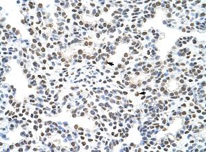 Tissue: Paraffin-embedded human lung Cells with positive label: Alveolar cells (indicated with arrows) Antibody concentration: 4 µg/ml Magnification: 400XTissue: Paraffin-embedded human lung Cells with positive label: Alveolar cells (indicated with arrows) Antibody concentration: 4 µg/ml Magnification: 400X
