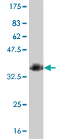 Western blot against tagged recombinant protein immunogen using ab55248 Homeo box C10 antibody at 1ug/ml.