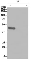 Immunoprecipitation analysis of human fetal brain labeling Homer with ab184955 at 1/50 dilution and Anti-rabbit IgG (HRP) specific to the non reduced form of IgG at 1/1500 dilution (+) or PBS (-)