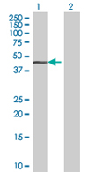 All lanes : Anti-HOMER2 antibody (ab68214) at 1/500 dilutionLane 1 : HOMER2 transfected 293T cell lysateLane 2 : Non-transfected 293T cell lysateLysates/proteins at 25 µg per lane.SecondaryGoat Anti-Mouse IgG (H&L)-HRP Conjugate at 1/2500 dilution