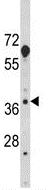 Anti-HOMER3 antibody (ab175852) at 1/1000 dilution + NIH3T3 cell line lysate at 35 µg