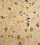 Immunohistochemical analysis of formalin-fixed, paraffin-embedded Human brain tissue labeling HOMER3 with ab175852 at 1/10 dilution, followed by peroxidase conjugation of the secondary antibody and DAB staining.
