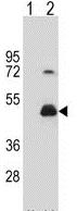 All lanes : Anti-HOMER3 antibody (ab175852) at 1/1000 dilutionLane 1 : Non-transfected 293 cell lysateLane 2 : 293 cell lysate transiently transfected with the HOMER3 geneLysates/proteins at 2 µg per lane.
