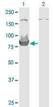 All lanes : Anti-HOOK3 antibody (ab118091) at 1 µg/mlLane 1 : HOOK3 transfected lysateLane 2 : Non-transfected lysateLysates/proteins at 25 µg per lane.developed using the ECL technique