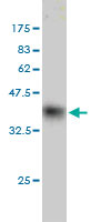 Western blot against tagged recombinant protein immunogen using ab57832 HOPX antibody at 1ug/ml.